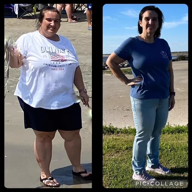 Medical Weight Loss Result - Before and After