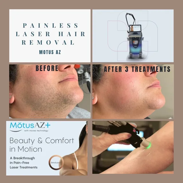 Laser Hair Removal Treatments